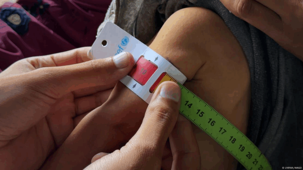 image-1-1024x576 A Escassez Como Arma em Gaza